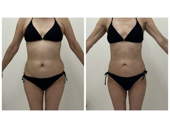 アミクール エステティックサロン(amicoeur)/60代でもこの変化