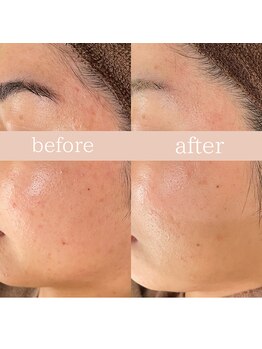 ハナワビューティーサロン(HanaWa beauty salon)/before&after