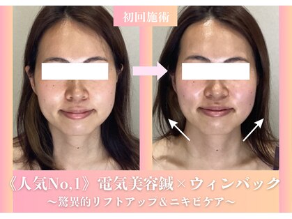 ミプラス鍼灸スタジオの写真