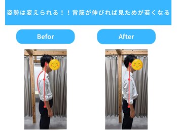 きくち整骨院/猫背・ストレートネック改善