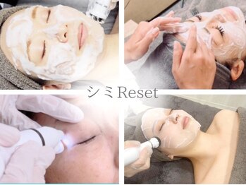 【医療提携サロン】シミReset名駅の写真/[Open記念*ベーシックシミケア¥6800]医療提携サロンの"結果を出す"シミケア。諦めていた肌に本気で変化を。