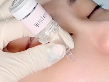 キラン(KIRAN)の写真/剥離ダウンタイムなし！最新の黒ずみケア！本来のピンク色に♪唇/目の下/バスト/VIO/わき/ひじ/など全身◎