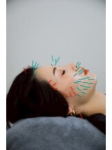 リノ ショウナン(LINO SHONAN)/変化にこだわり抜いた美容鍼