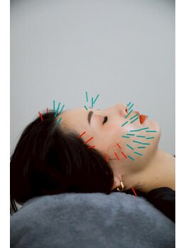 リノ ショウナン(LINO SHONAN)/変化にこだわり抜いた美容鍼