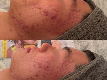 ポーデベロア(Peau des velours)/陶肌トリートメント/ホームケア