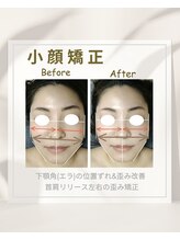 イチカ 仙川店( ichika)/小顔矯正歪み改善