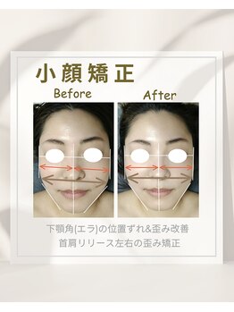 イチカ 仙川店( ichika)/小顔矯正歪み改善