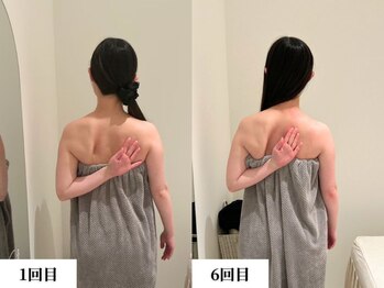 ソレア(Solea)の写真/【ドレス姿に自信を。姿勢から叶えるブライダル整体】360°どこから見ても美しい姿勢に。