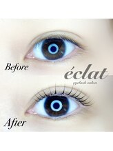 エクレ(eclat)/L3リフト