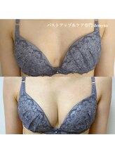 デミーナ(Demyna)/【バストアップ】症例 育乳