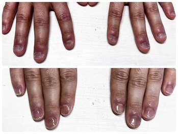 ヴェールリム(verl lim)/