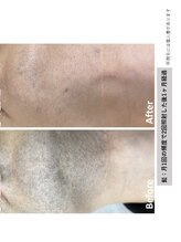 エースビューティー(Ace.Beauty)/