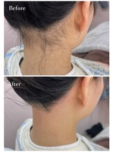 ホワイトワックス 京都四条烏丸(WHITE WAX)/うなじワックス