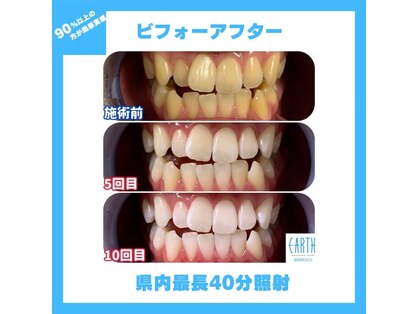ホワイトニングサロン アース 福岡姪浜店(EARTH)の写真