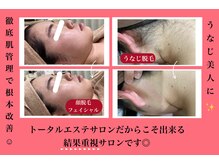 エステティック レイビス 八戸店(RAYVIS)