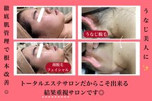 エステティック レイビス 八戸店(RAYVIS)