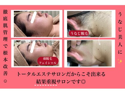 エステティック レイビス 八戸店(RAYVIS)の写真