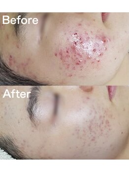 ラ ジェム(La gemme)/【トロイアルケ】