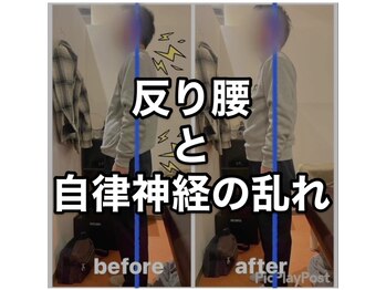 カワル整体 上通り院/反り腰と自律神経失調の関係