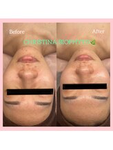 シュ シェリー(chou cherie)/CHRISTINA BIOPHYTO