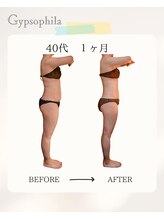 ジプソフィラ(Gypsophila)/痩身ビフォーアフター