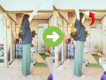 サプライズ整体院/30代ママさんの肩こり初回結果