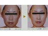 人気No1イチオシ【たるみシワ改善】エンダモロジーフェイシャル 80分 ¥16000