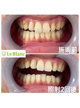 ルブラン 奈良店(Le Blanc)/男性の方も通いやすい