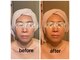 ディグニータココ 自由が丘(DIGNITA coco)の写真