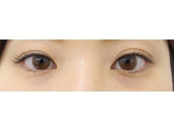 ビームズ トータルビューティー 西中島店(BeeMs Total Beauty)/【フレッシュ】シングル80本