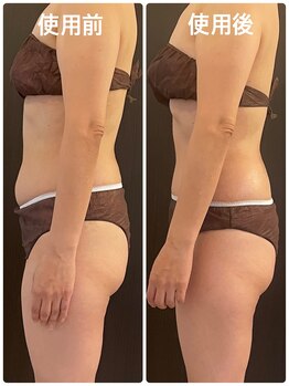 ルーシーガーデン(LUCY GARDEN)/【気になる部分】集中ケア/50代