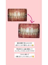 エクシアホワイト 山形西バイパス店/ビフォーアフター