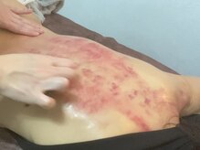 エミール(EMIIR)の雰囲気（グアサー(かっさ)は施術後のスッキリ感がやみつきに☆）