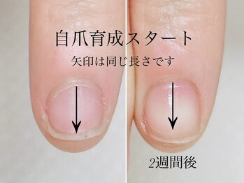 トゥインクリーネイルサロン(Twinkly Nail Salon)/【最強のネイルケア】1回お試し