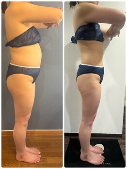 アミナス(Total Beauty Salon AMINAS)/ダイエットならお任せ♪