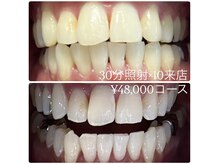 ホワイトニングルーム 横浜店(Whitening Room)/セルフホワイトニング/横浜