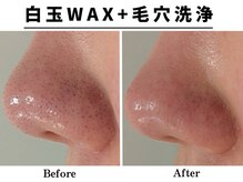 リッチ(Rich+)の雰囲気（白玉WAX＋毛穴洗浄1回での効果です◎感動の仕上がりになります！）