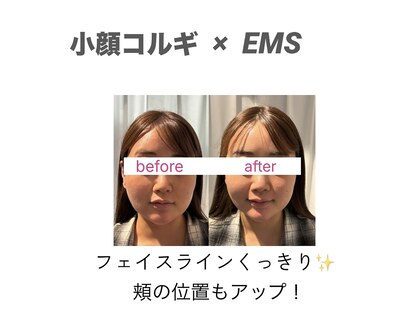 ファブ(Fab)の写真
