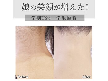 グランピピ(Grand PiPi)の写真/学生脱毛から介護脱毛まで♪親子で通える女性専用サロン