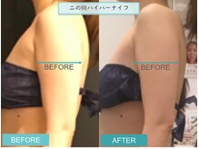 プライマルビューティ 艶 本店(Primal Beauty)/本気の痩身！ADEで痩せよう！