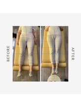 多摩 唐木田整体室/産後骨盤のビフォーアフター