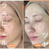多穏スキンケア(skin care)