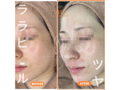 多穏スキンケア(skin care)の写真