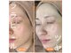 多穏スキンケア(skin care)の写真