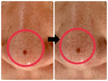 エフェクト 塚口店(effect)/before after