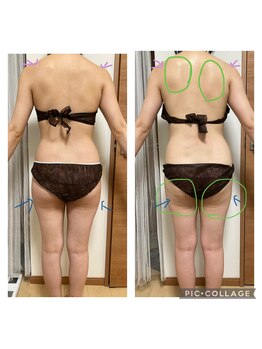 ヨサパーク カズリー(YOSA PARK kazury)/ルルオン1回での変化です!