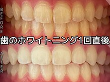 ヴィオール 名古屋栄店(VIOR)/ホワイトニング で輝く笑顔に！