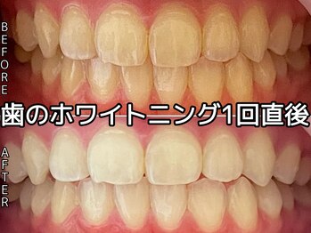 ヴィオール 名古屋栄店(VIOR)/ホワイトニング で輝く笑顔に！