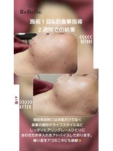 リベル(ReBelle.)/
