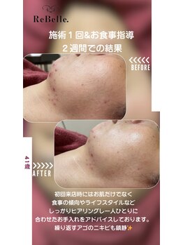 リベル(ReBelle.)/